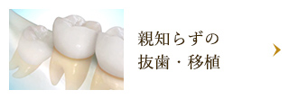 親知らずの抜歯・移植