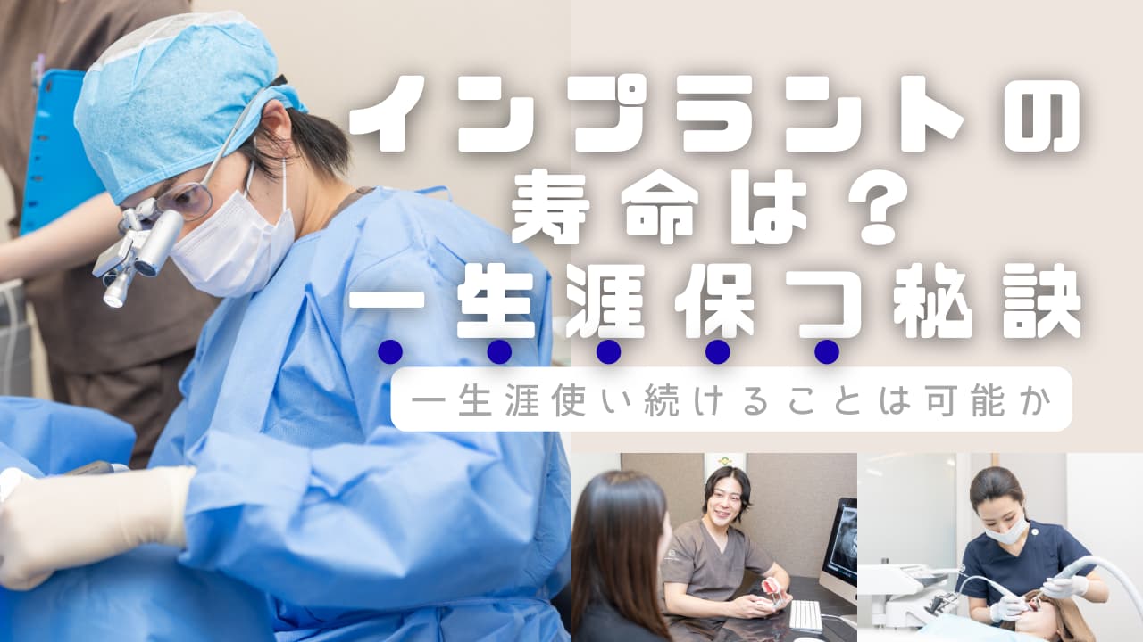 インプラントの寿命は？一生涯保つ秘訣