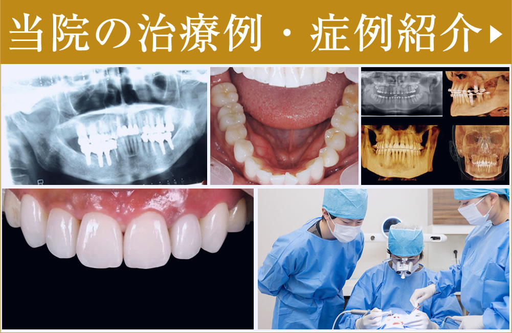 症例・治療例