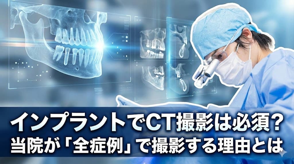 インプラントでCT撮影は必要？当院が「全症例」で撮影する理由とは